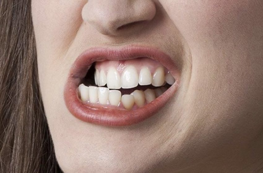  ١٠ مرحله مهم مراقبت از دندان برای داشتن لبخندی زیبا